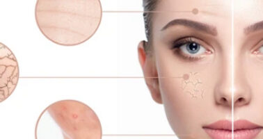 Skin Clinic in bhubaneswar