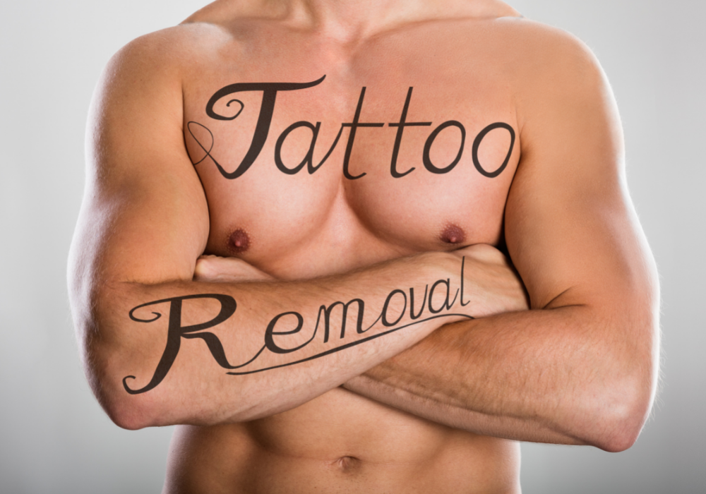 Tattoo Removal in Bhubaneswar | Radiance Skin & Hair Clinic