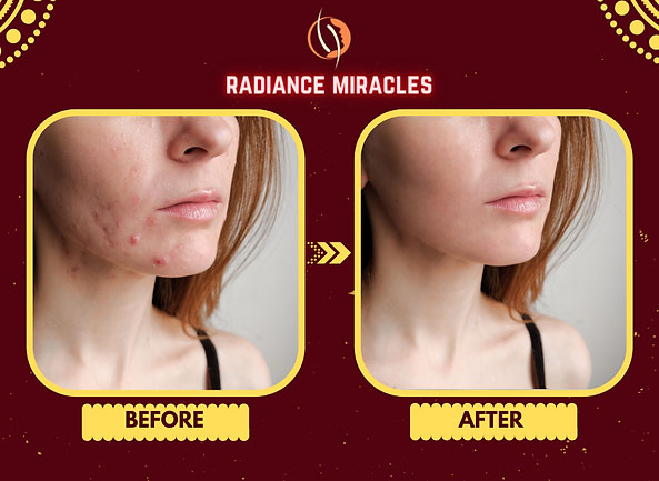 Skin care at Radiance