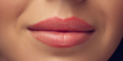 Lip-Pigmentation