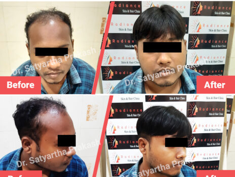 Hair Wig Clinic Bhubaneswar