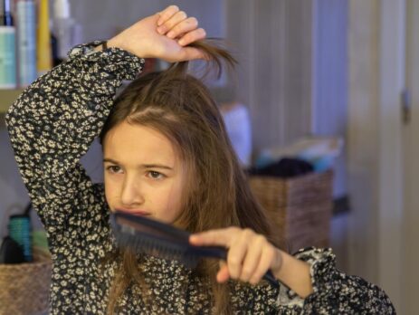 How Does Hair Loss Affect an Individual’s Confidence Level