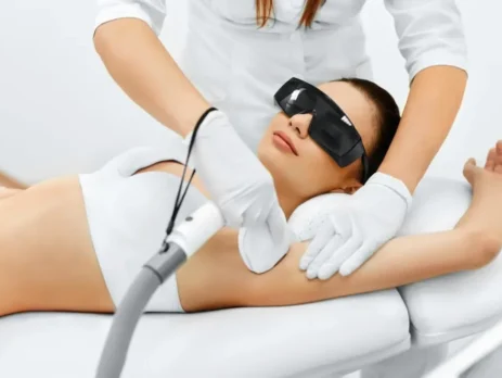 Laser hair removal
