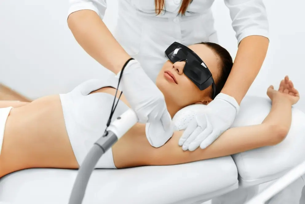 Laser hair removal