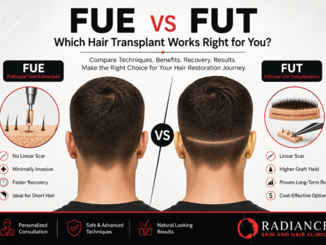 FUE vs FUT hair transplant comparison