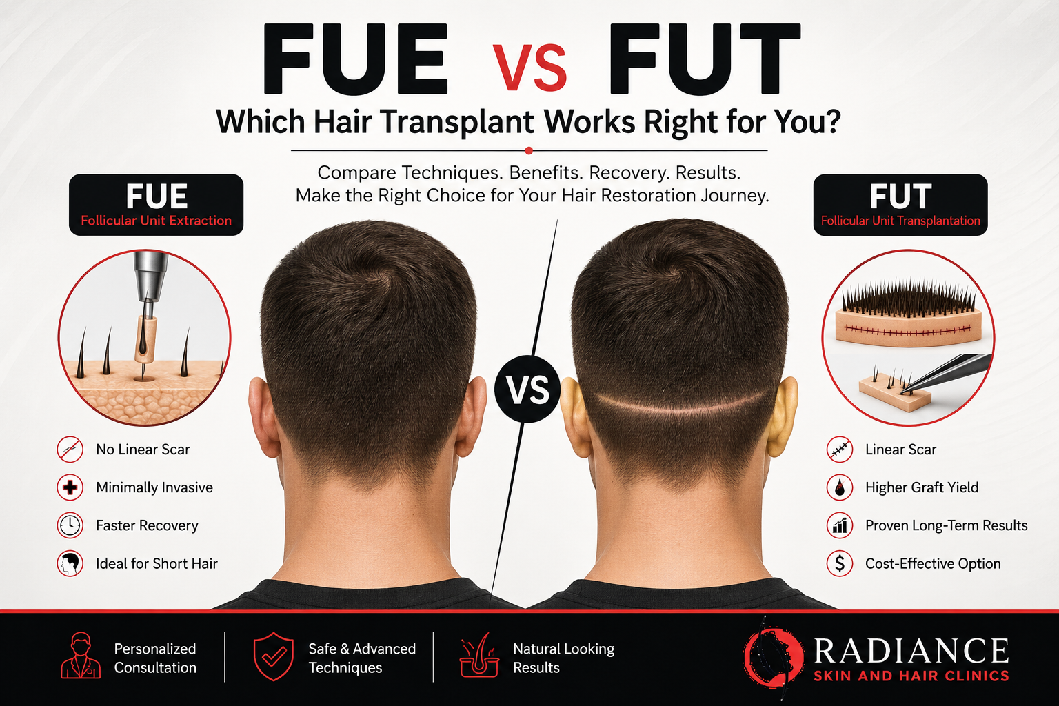 FUE vs FUT hair transplant comparison