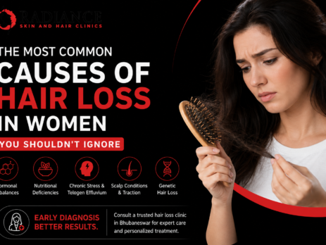 Common causes of hair loss in women